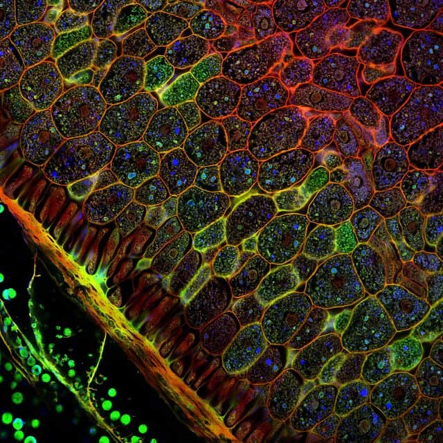 Plant Tissue | Botany | Lecture notes of Botany - PrepArmy